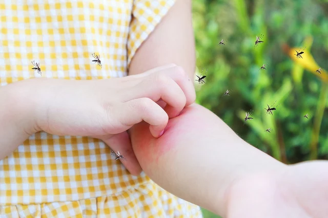 Levocetirizine for Insect Bite Allergies: A Possible Remedy