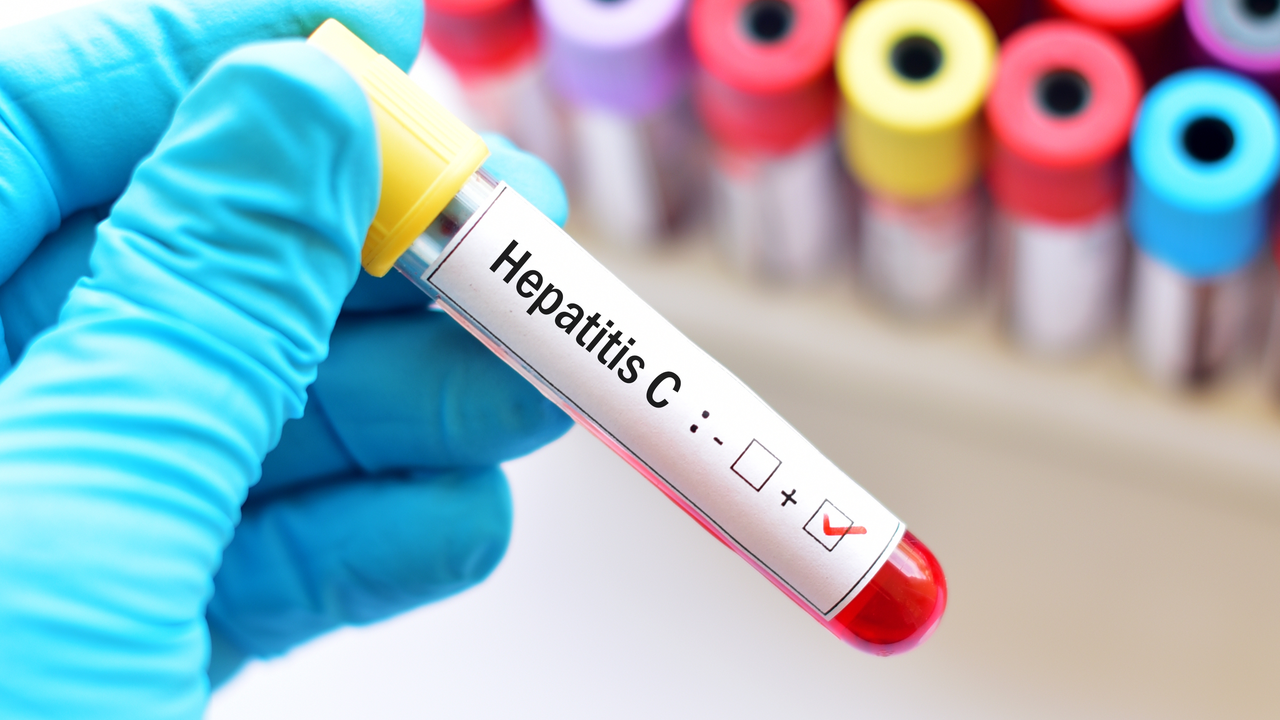 Genotype 3 Chronic Hepatitis C and Pregnancy: What You Need to Know
